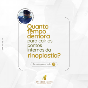 Quanto tempo demora para cair os pontos internos da rinoplastia?